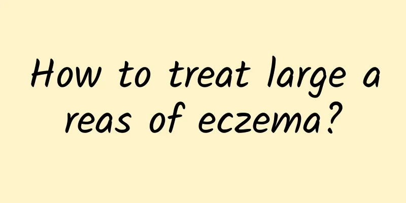 How to treat large areas of eczema?