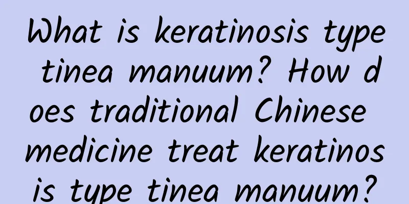 What is keratinosis type tinea manuum? How does traditional Chinese medicine treat keratinosis type tinea manuum?