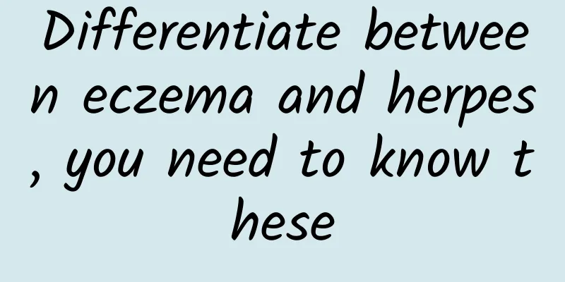 Differentiate between eczema and herpes, you need to know these