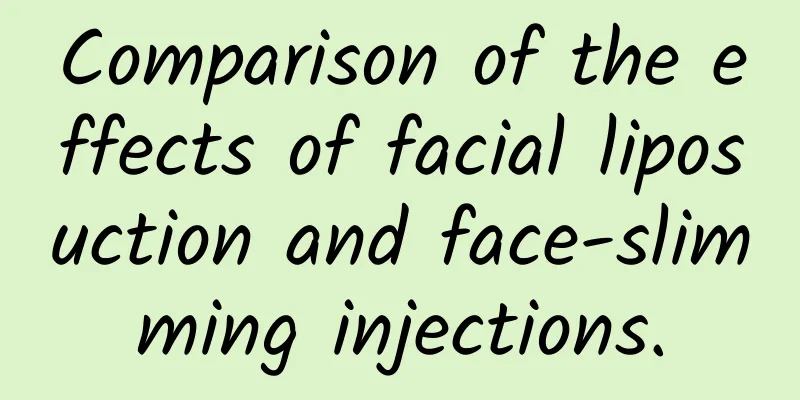 Comparison of the effects of facial liposuction and face-slimming injections.
