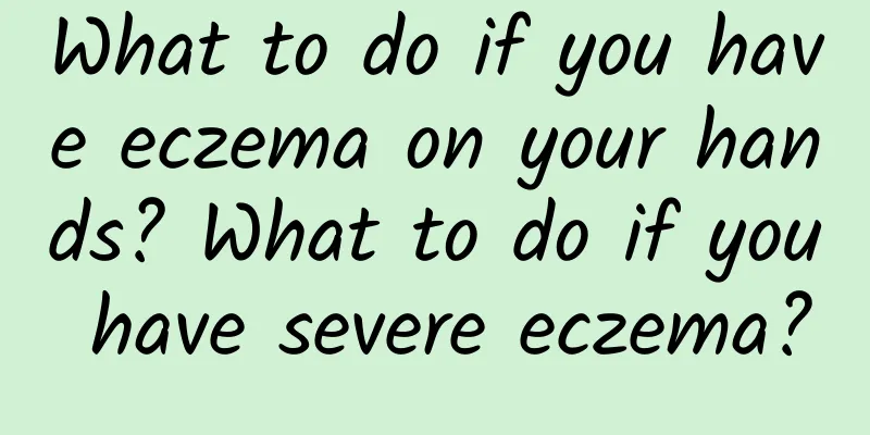 What to do if you have eczema on your hands? What to do if you have severe eczema?