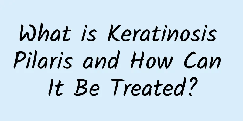 What is Keratinosis Pilaris and How Can It Be Treated?