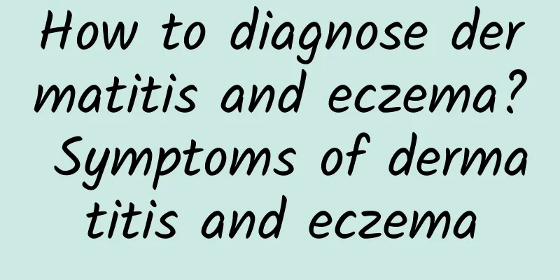 How to diagnose dermatitis and eczema? Symptoms of dermatitis and eczema