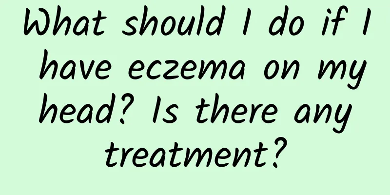 What should I do if I have eczema on my head? Is there any treatment?