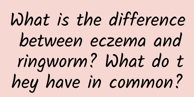 What is the difference between eczema and ringworm? What do they have in common?