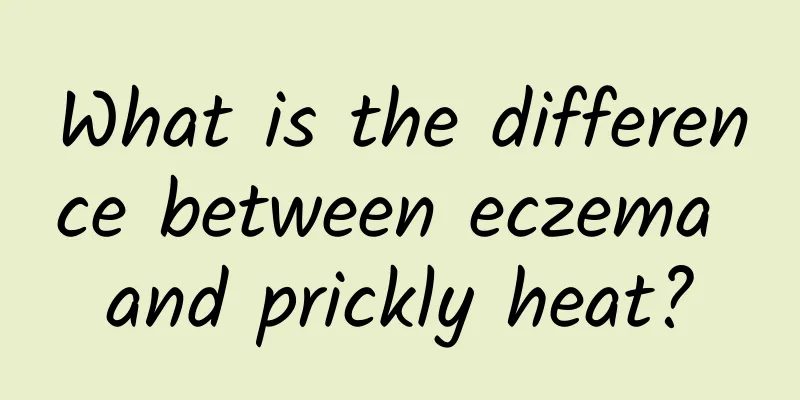 What is the difference between eczema and prickly heat?