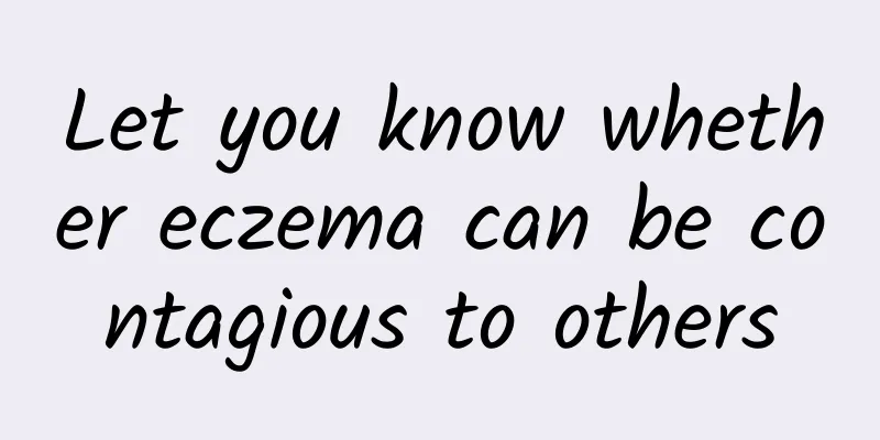 Let you know whether eczema can be contagious to others