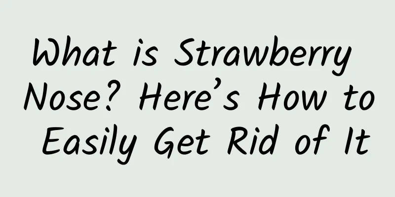 What is Strawberry Nose? Here’s How to Easily Get Rid of It