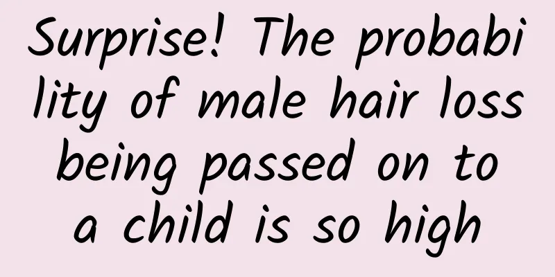 Surprise! The probability of male hair loss being passed on to a child is so high