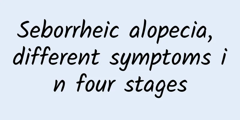 Seborrheic alopecia, different symptoms in four stages