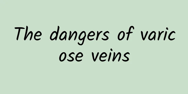The dangers of varicose veins