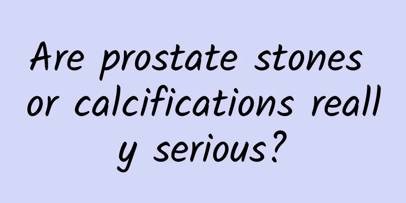 Are prostate stones or calcifications really serious?
