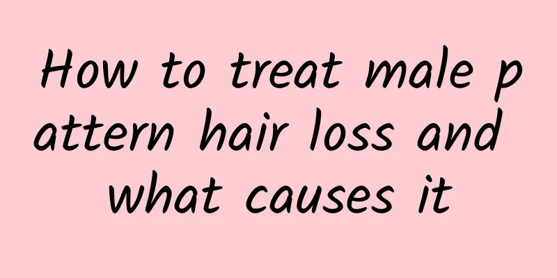 How to treat male pattern hair loss and what causes it