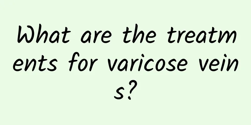 What are the treatments for varicose veins?