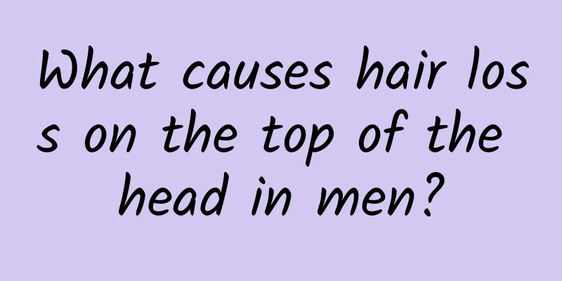 What causes hair loss on the top of the head in men?