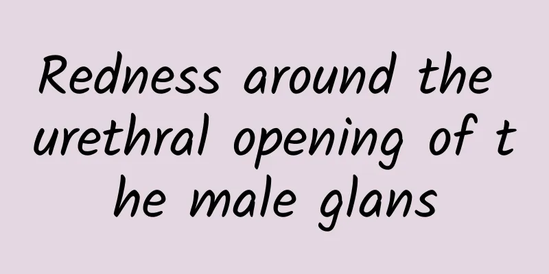Redness around the urethral opening of the male glans