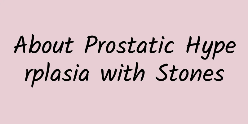 About Prostatic Hyperplasia with Stones