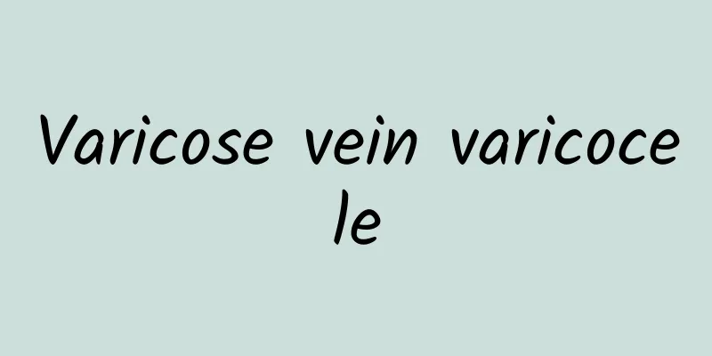 Varicose vein varicocele