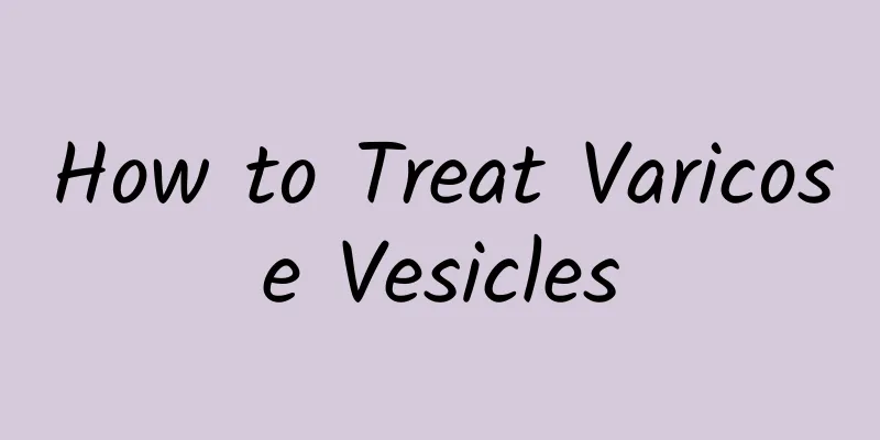 How to Treat Varicose Vesicles
