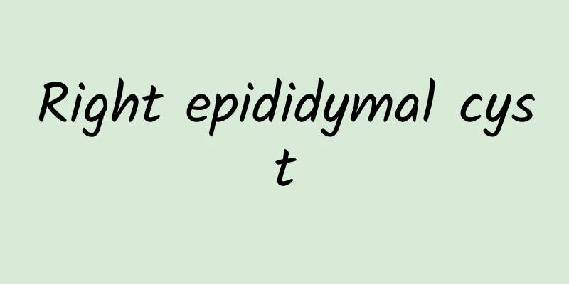 Right epididymal cyst
