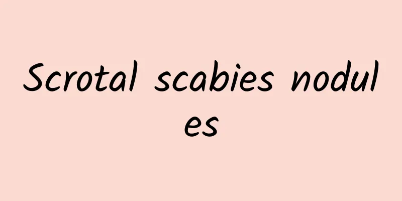 Scrotal scabies nodules
