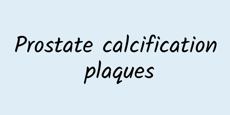 Prostate calcification plaques